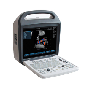 Aparatus Diagnostik Ultrasonik Doppler Warna Digital KAI-A8